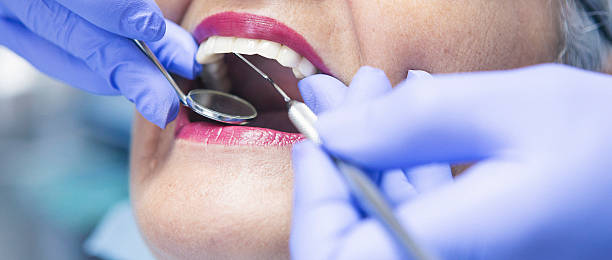 Best Emergency Dental Care for Sports Injuries in Three Way, TN